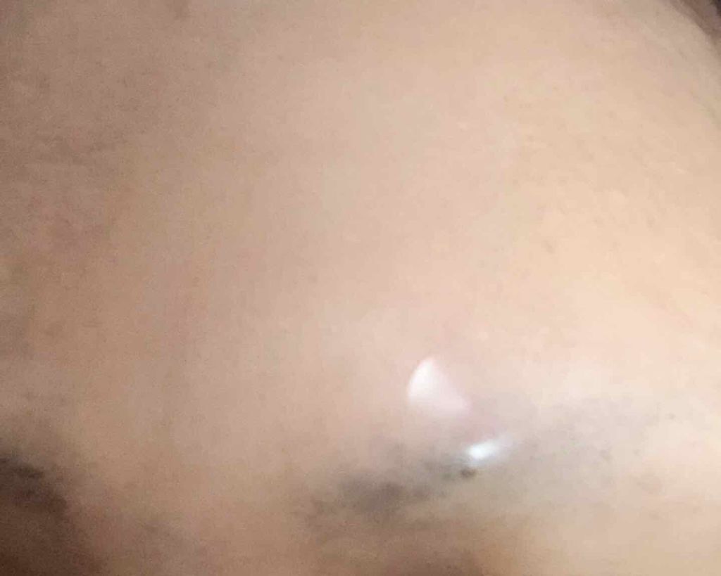 Secret solution Clear Patch/It's skin/シートマスク・パックを使ったクチコミ(2枚目)