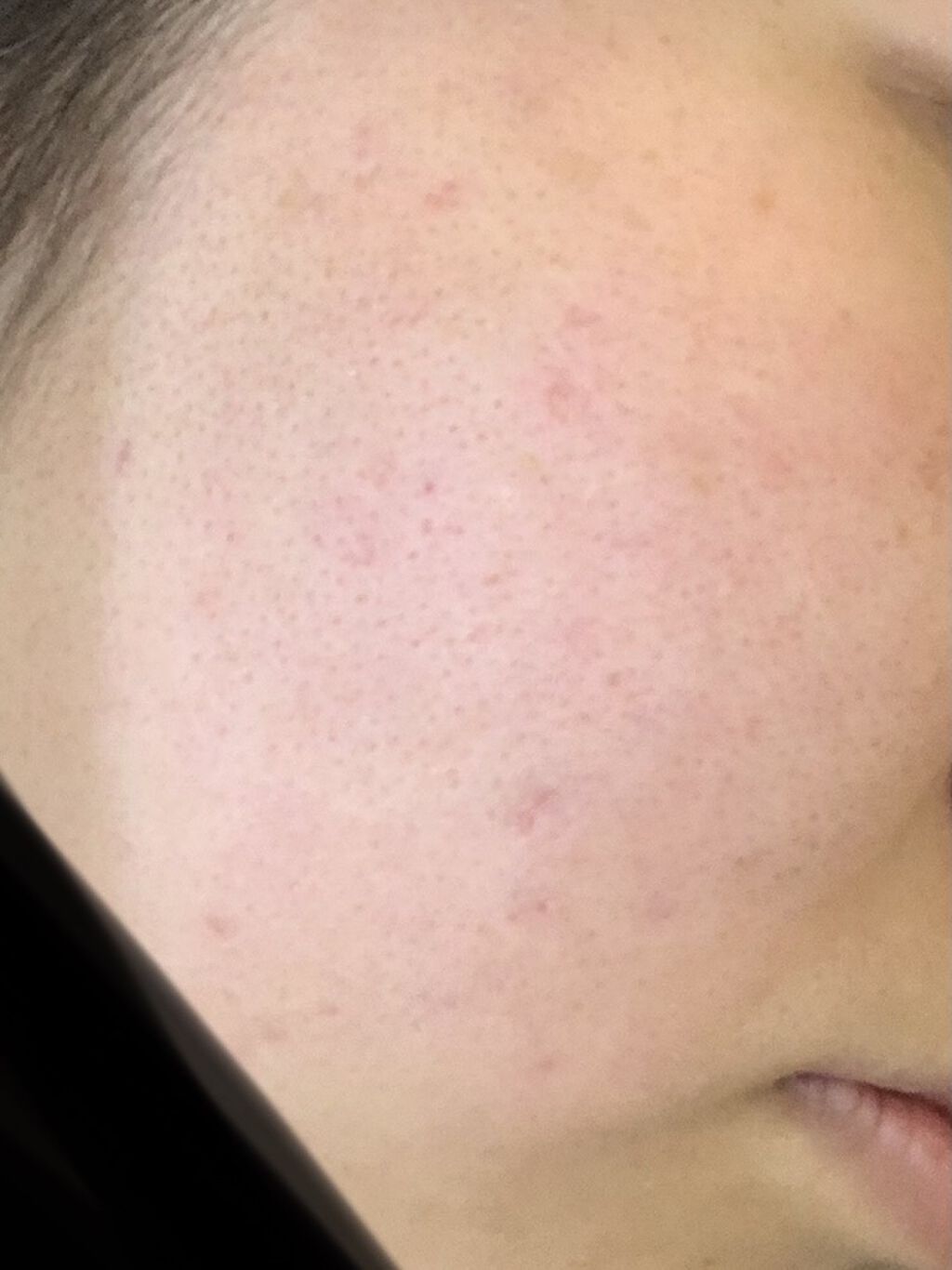 ハトムギ保湿ジェル(ナチュリエ スキンコンディショニングジェル)/ナチュリエ/美容液を使ったクチコミ（3枚目）