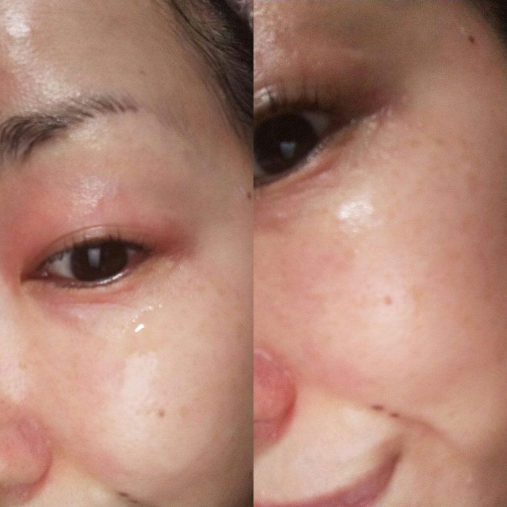 アスハダ-ASHADA-美容液(パーフェクトクリアエッセンス) /アスハダ/美容液を使ったクチコミ（3枚目）