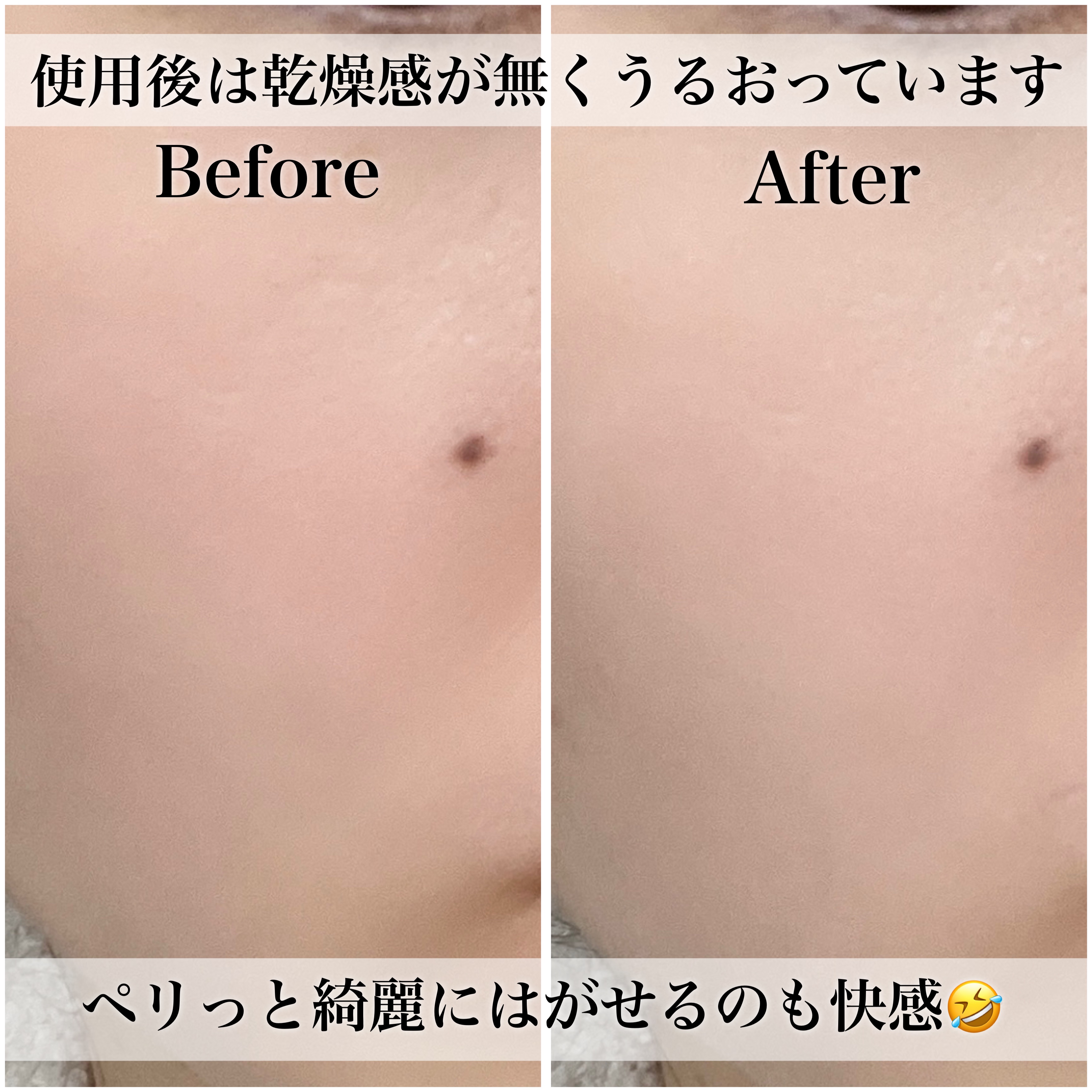 ラスティングCO2イルミネイトジェルマスク/BYOU/シートマスク・パックを使ったクチコミ（3枚目）