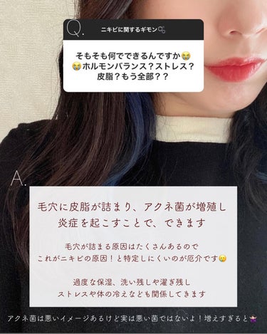 yuyu🐶肌荒れ体質の正直レビュー on LIPS 「ニキビに関する「これはなんで？！😳」を解決💡✼••┈┈••✼•..」（2枚目）