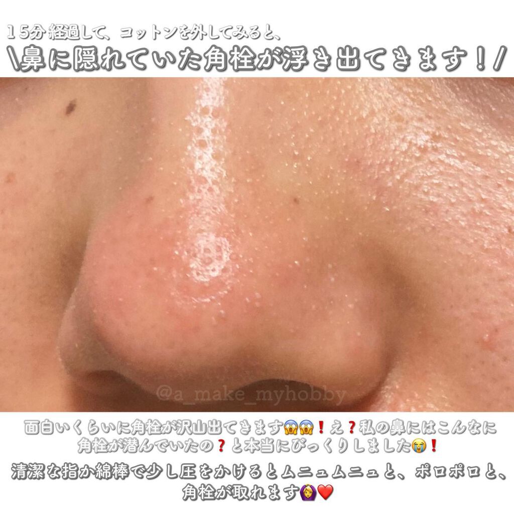 ノーモアブラックヘッド(ノーズピーリング)/One-day's you/スクラブ・ゴマージュを使ったクチコミ(5枚目)