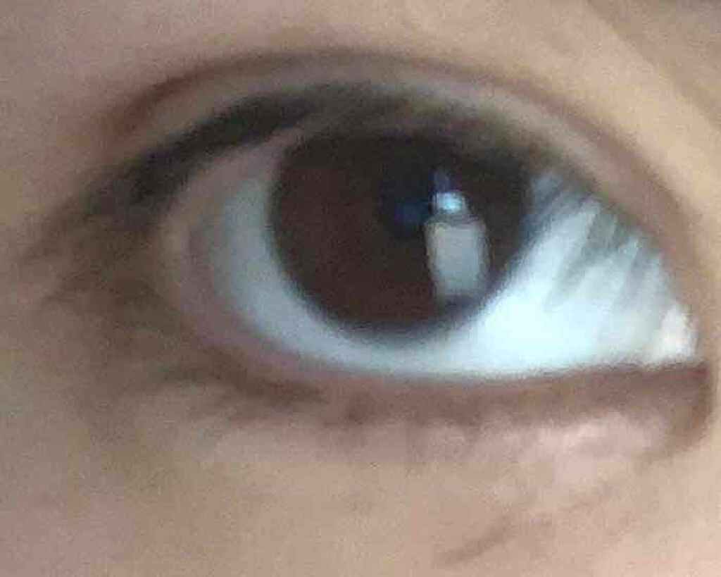 ゆーりかの葉っぱ on LIPS 「事前に早めに来るよう言われていたので30分前に病院へ行きました..」(2枚目)