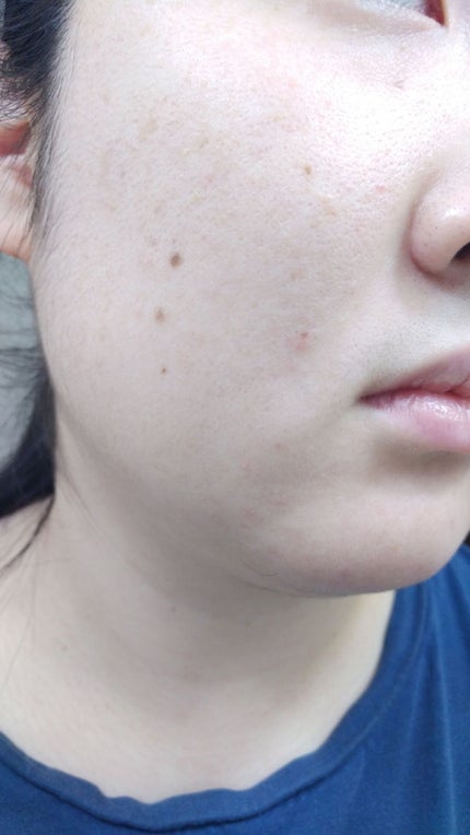 アンブリオリス モイスチャークリーム/アンブリオリス/フェイスクリームを使ったクチコミ(2枚目)