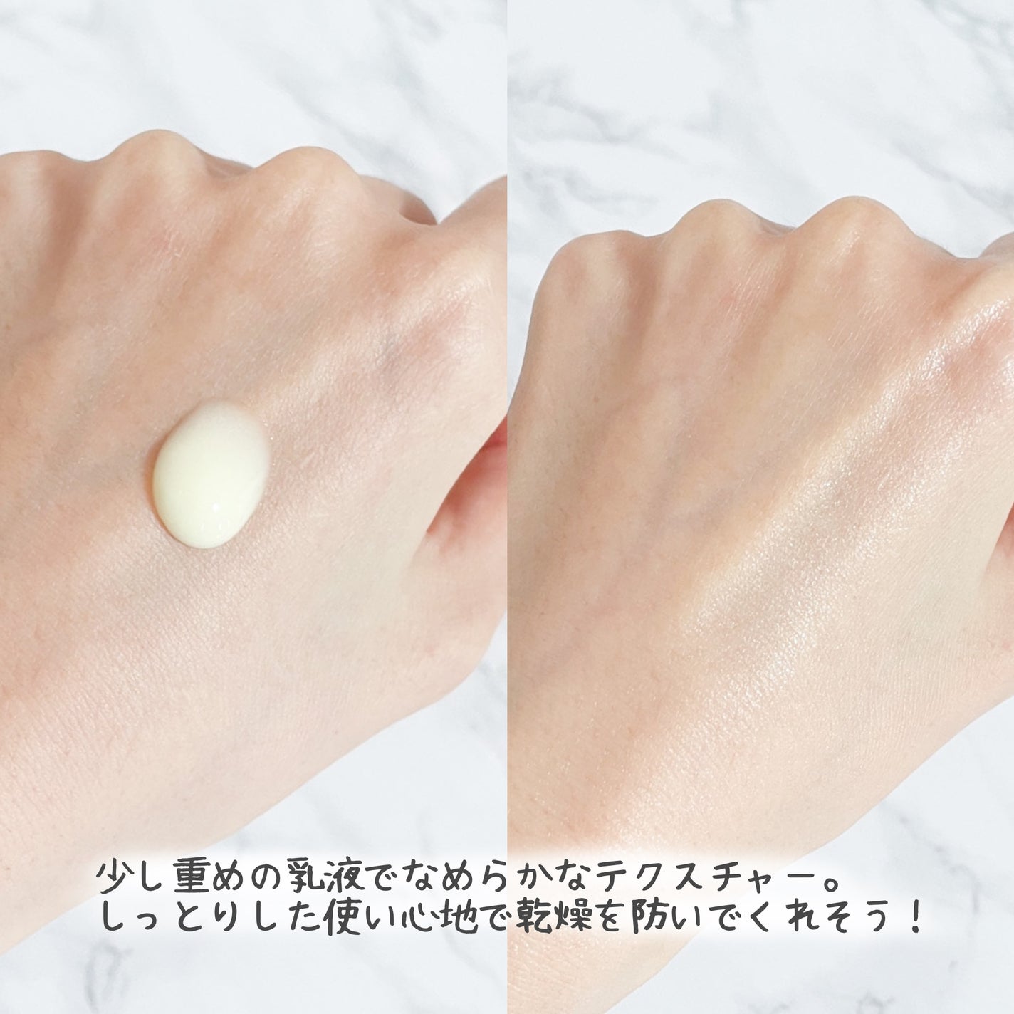 ドクターケイ 薬用Cリンクルホワイトミルク<医薬部外品>/ドクターケイ/乳液を使ったクチコミ(3枚目)