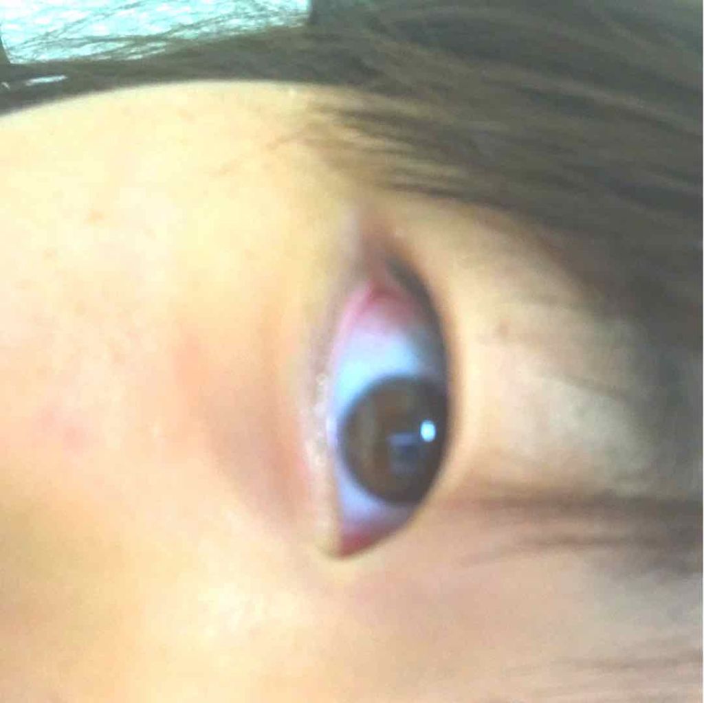 ハイブリッドフィルム/アイトーク/二重まぶた用アイテムを使ったクチコミ（2枚目）