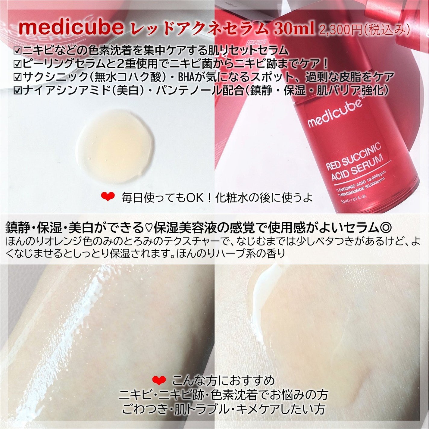 レッドアクネピーリングセラム/MEDICUBE/美容液を使ったクチコミ(2枚目)
