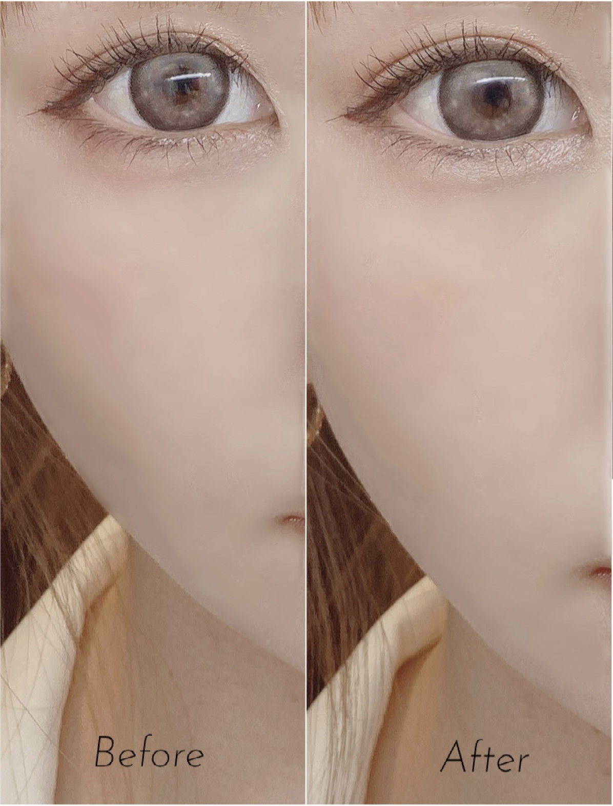 アイセラムコンシーラー/ティンカーウィンク/ペンシルコンシーラーを使ったクチコミ（2枚目）