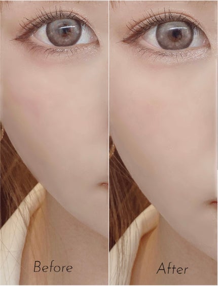 アイセラムコンシーラー/ティンカーウィンク/ペンシルコンシーラーを使ったクチコミ(2枚目)