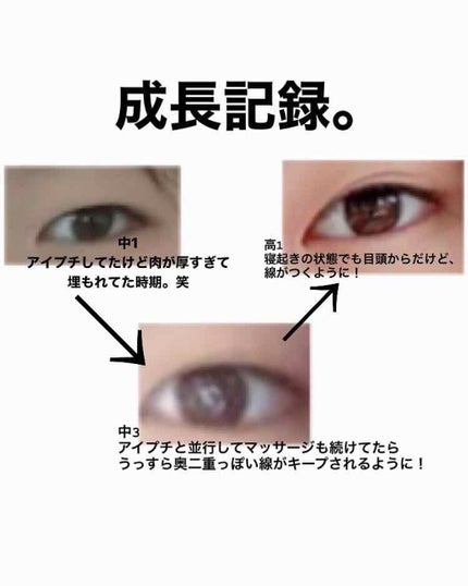 肌色タイプ/バンドエイド/その他を使ったクチコミ(2枚目)