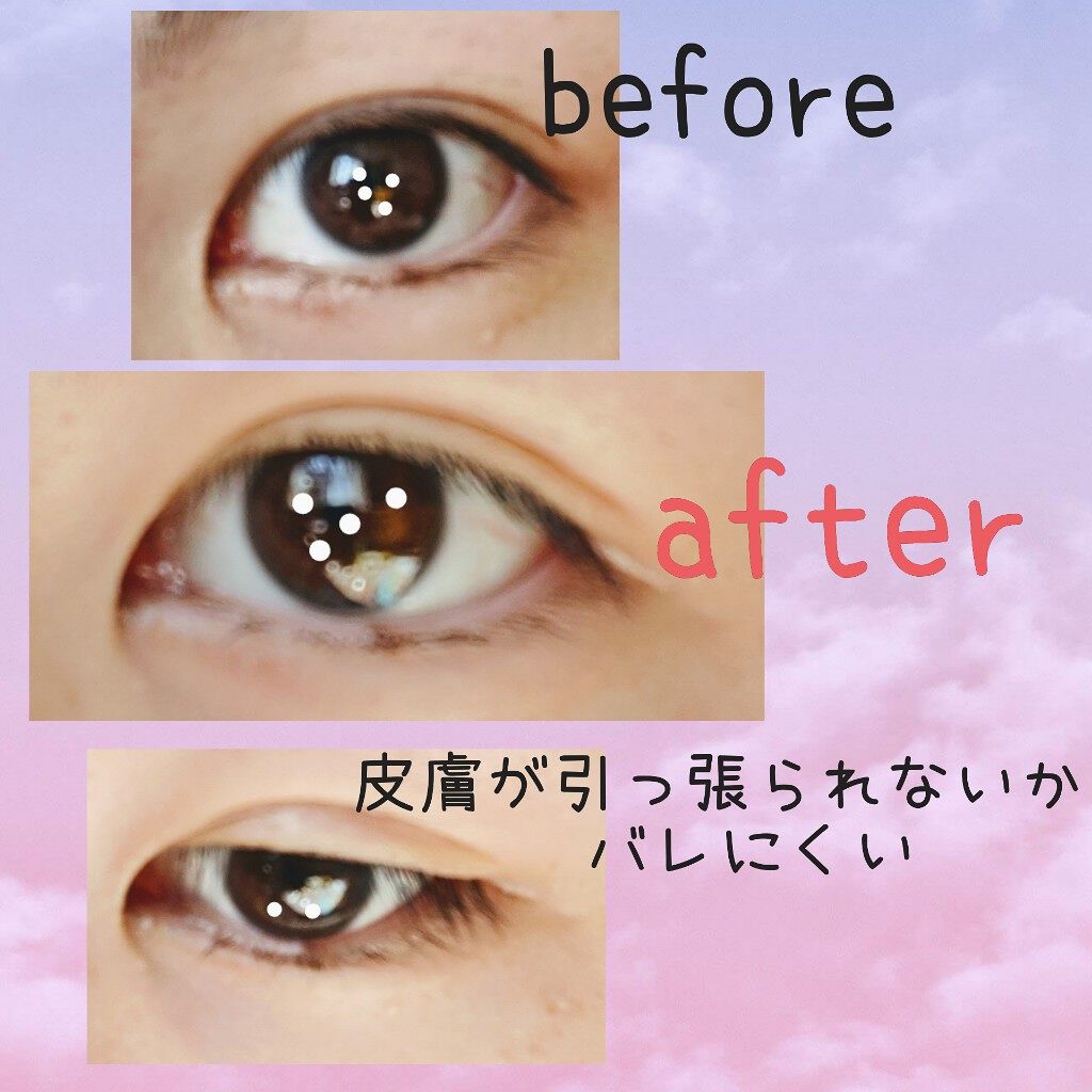 ルドゥーブル プレミアム/ルドゥーブル/二重まぶた用アイテムを使ったクチコミ(1枚目)
