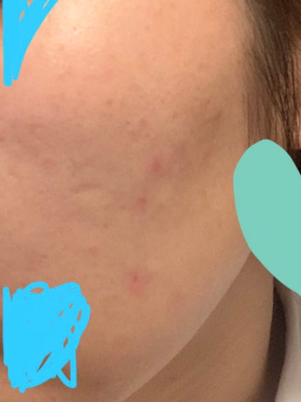 ミノン アミノモイスト モイストチャージ ミルク/ミノン/乳液を使ったクチコミ(3枚目)