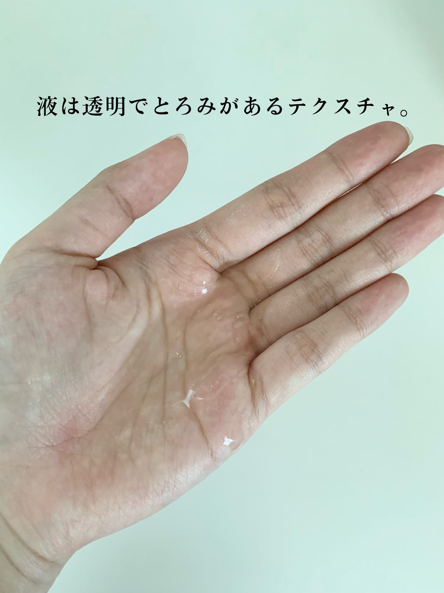 ダーマレーザー スーパーVC100ローション(さっぱり)/クオリティファースト/化粧水を使ったクチコミ(3枚目)