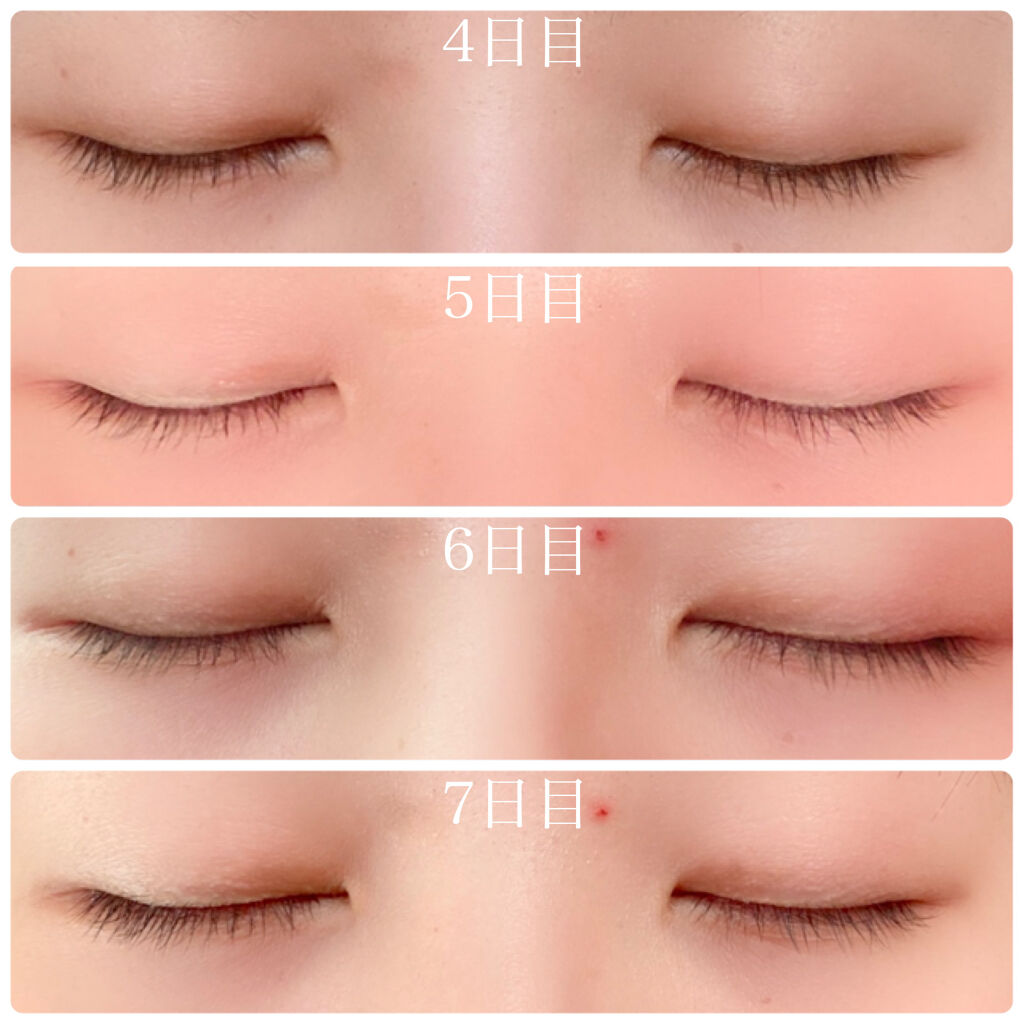 EMAKED（エマーキット）/水橋保寿堂製薬/まつげ美容液を使ったクチコミ（3枚目）