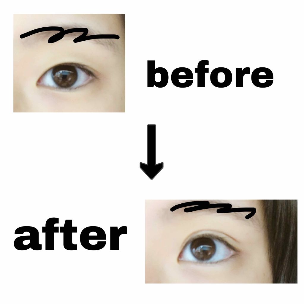 ハイブリッドフィルム/アイトーク/二重まぶた用アイテムを使ったクチコミ(4枚目)