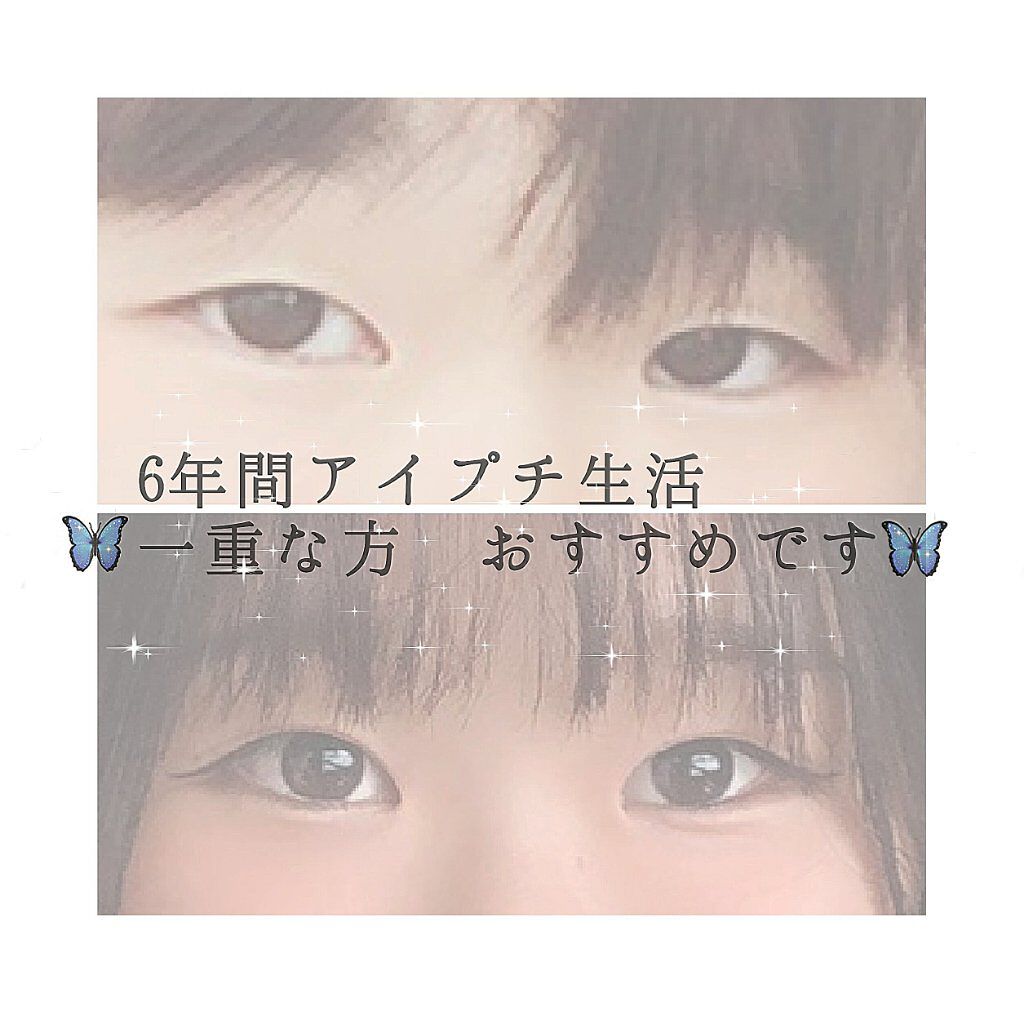 ガールズメーカー エタニティラインa Girl S Makerの口コミ 生まれつき一重 二重になりたかった 中学に By Miii 代前半 Lips