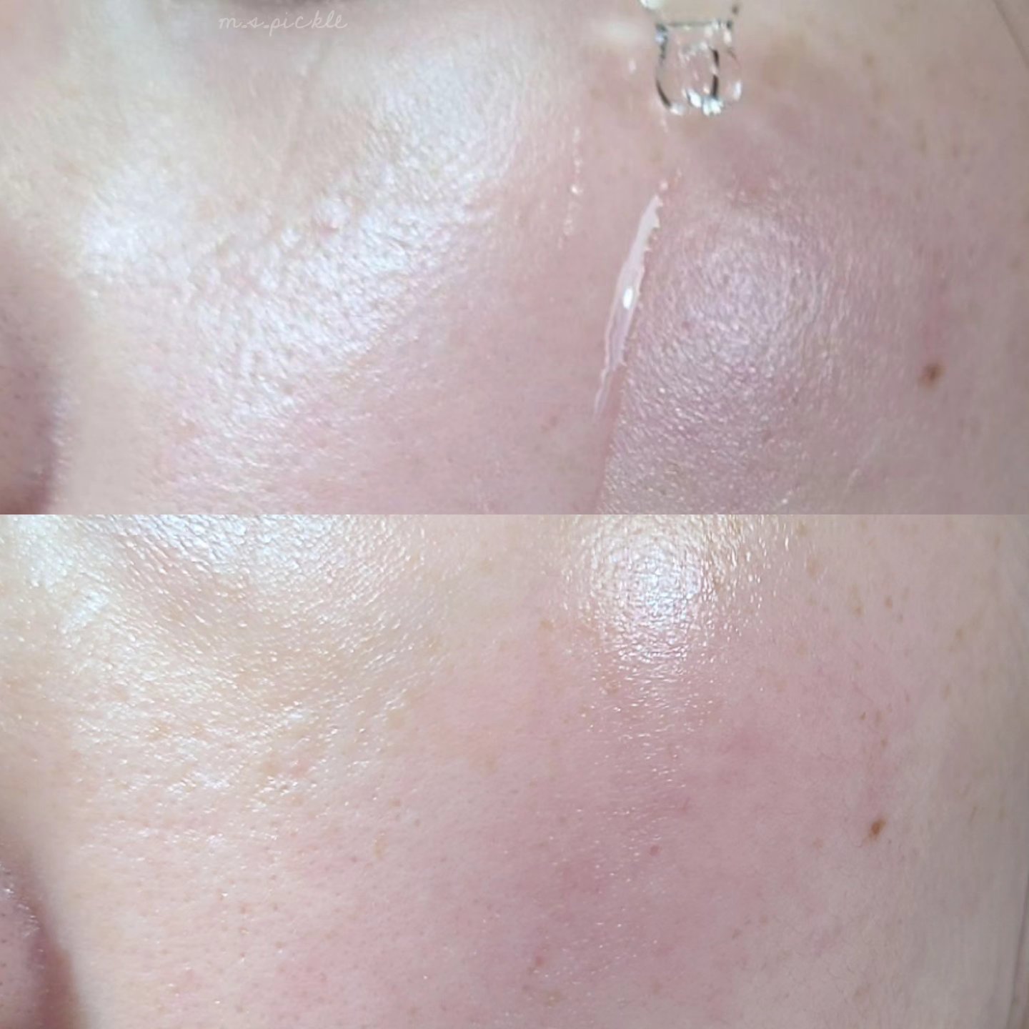 プロポリスレスキューアンプル 50ml/CNP Laboratory/美容液を使ったクチコミ（3枚目）