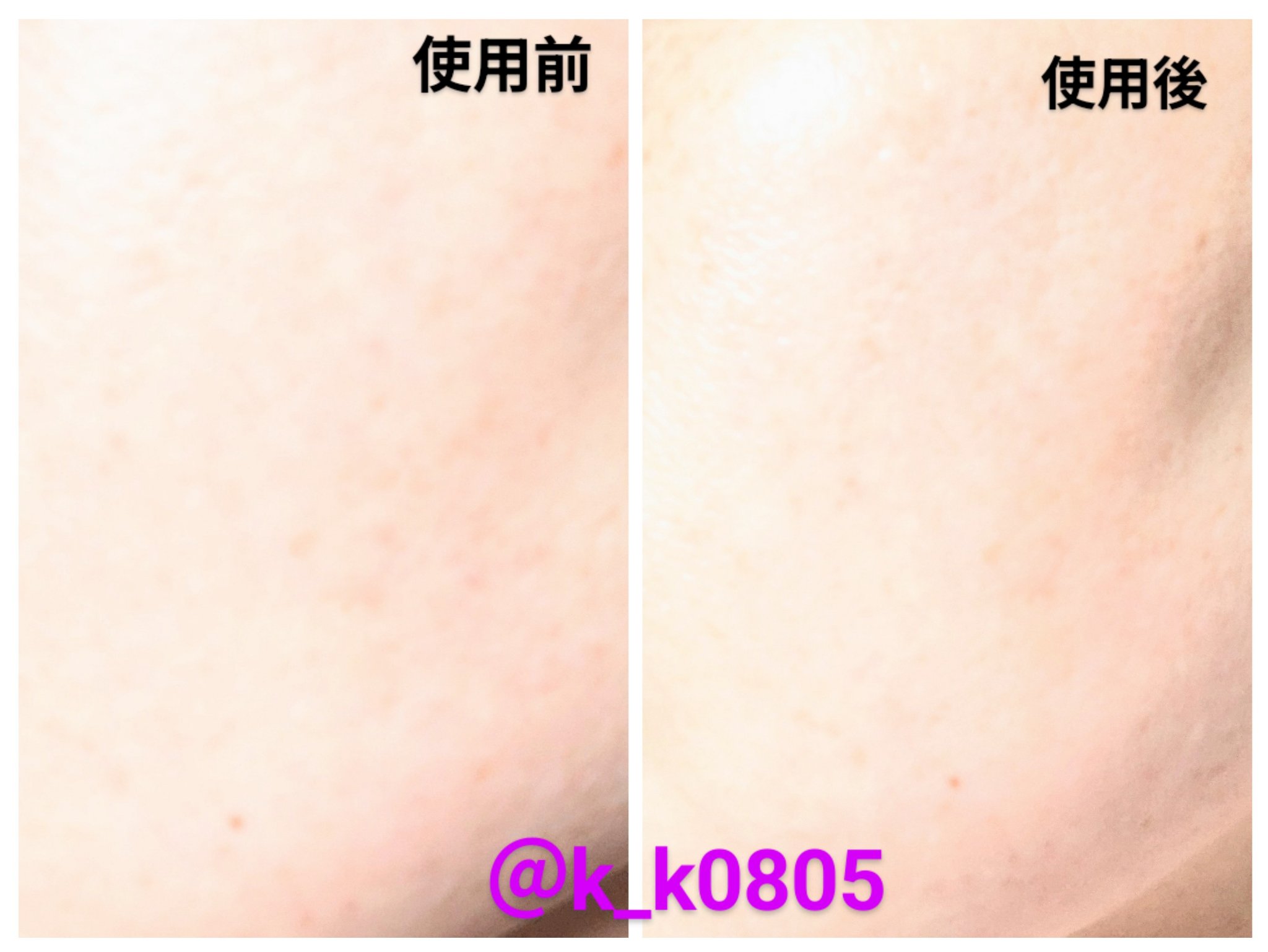 ANTIOXIGEN パッククレンザー/大熊製薬/その他洗顔料を使ったクチコミ（3枚目）