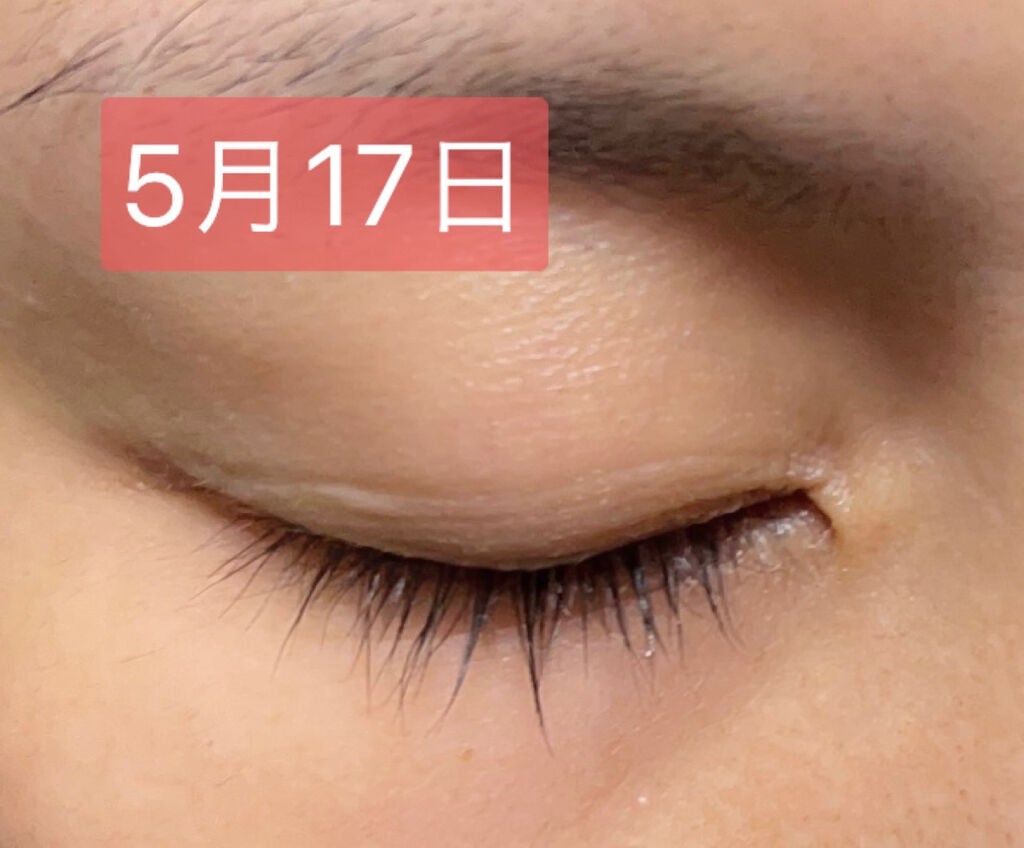 アヴァンセ ラッシュセラム EX(医薬部外品)/アヴァンセ/その他を使ったクチコミ(5枚目)