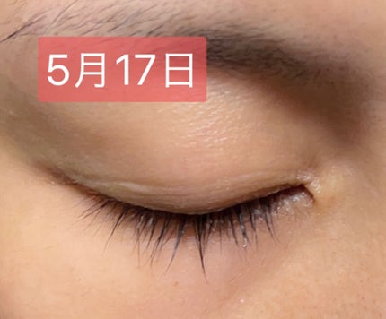 アヴァンセ ラッシュセラム EX(医薬部外品)/アヴァンセ/その他を使ったクチコミ(5枚目)