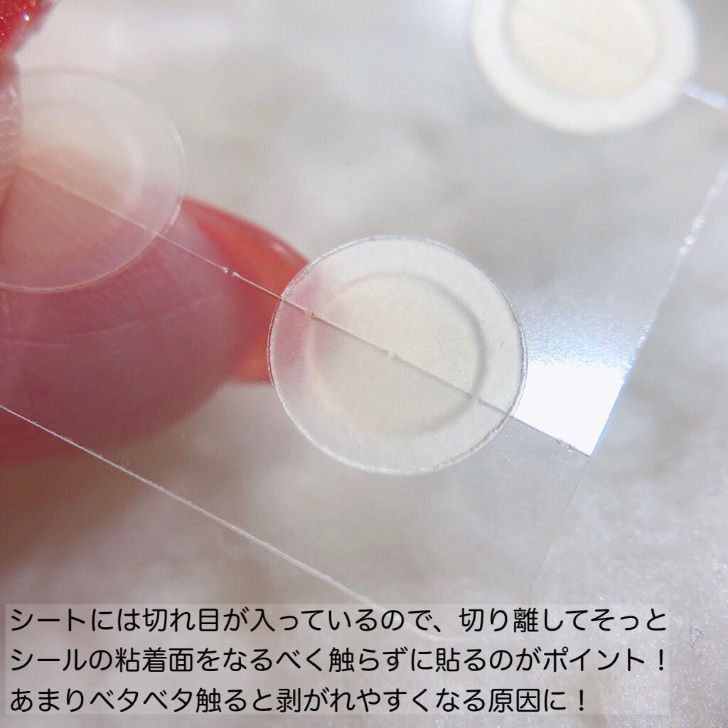 ゼロスポットパッチ/Today’s Cosme/にきびパッチを使ったクチコミ(3枚目)