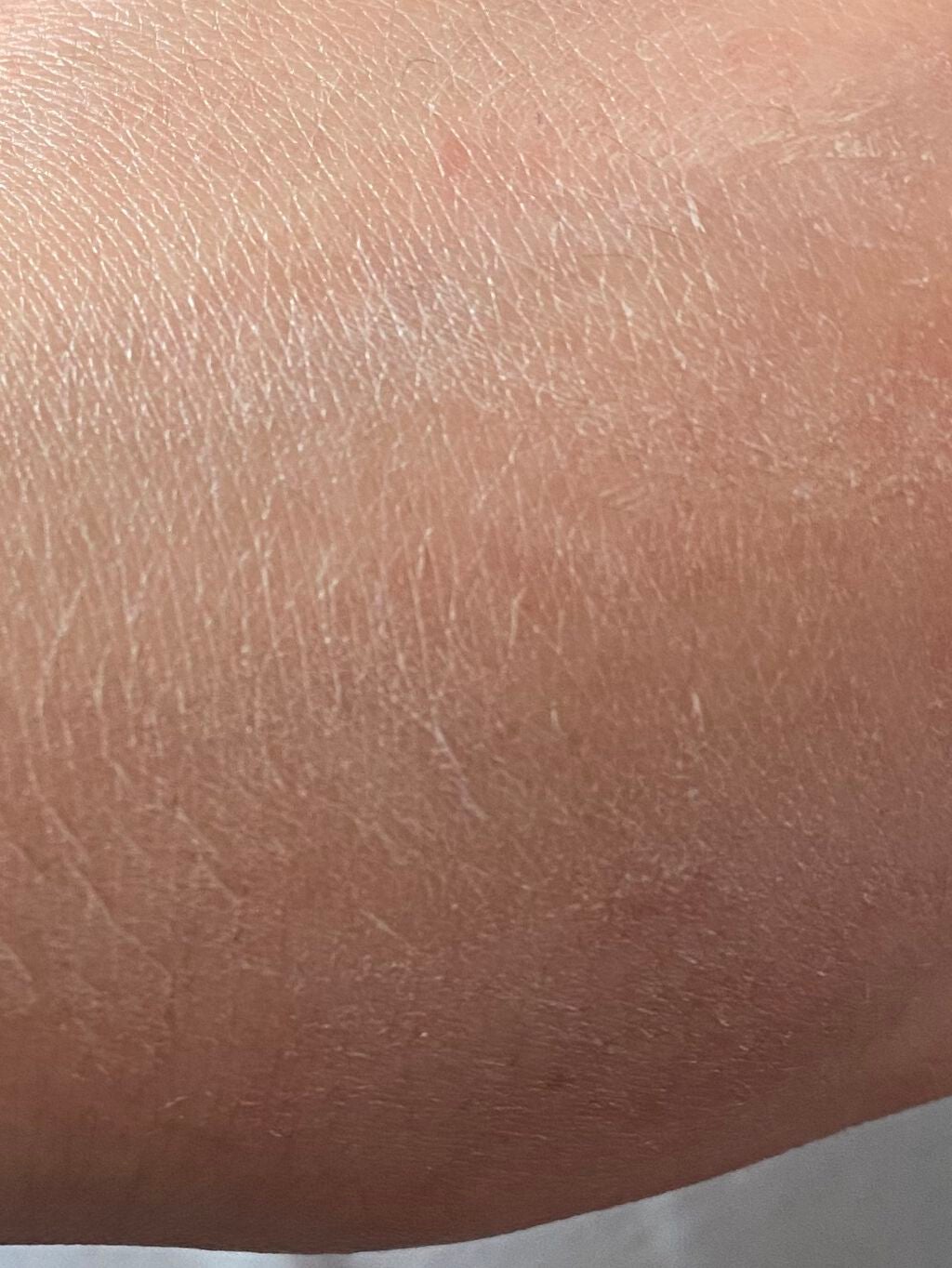 ユースキン/ユースキン/ボディクリームを使ったクチコミ(4枚目)