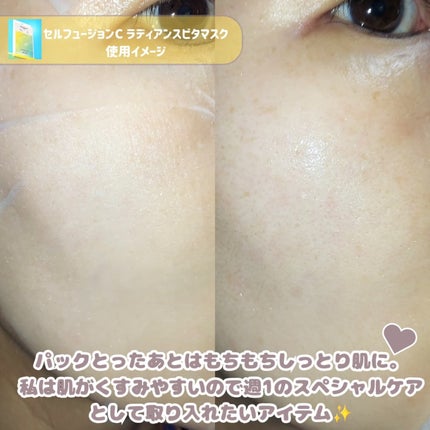 ラディアンスビタマスク/Cell Fusion C(セルフュージョンシー)/シートマスク・パックを使ったクチコミ(5枚目)