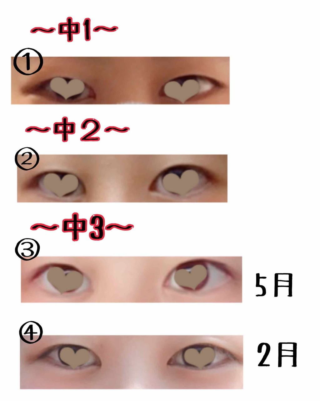 ワンダーアイリッドテープ Extra/D-UP/二重まぶた用アイテムを使ったクチコミ(2枚目)