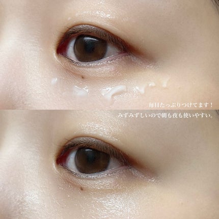 AHC アイクリームのクチコミ「
韓国でシリーズ累計1億本売れたアイクリーム。
AHC エッセンシャルリアルアイクリームフォ.....」(3枚目)