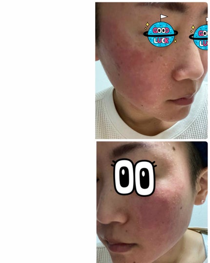 ミラミックス/ZO Skin Health/フェイスクリームを使ったクチコミ(2枚目)