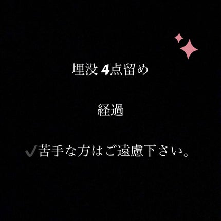 二重整形/その他を使ったクチコミ(1枚目)