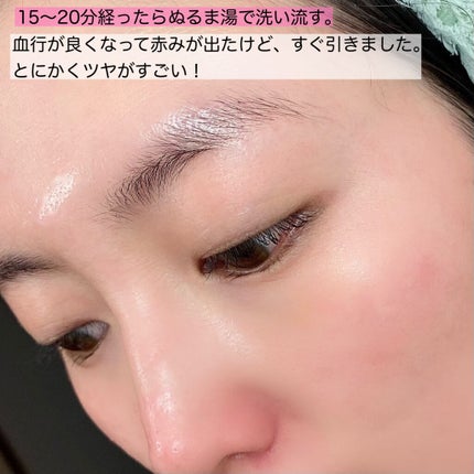 リフトブライトCO2パック/yourline/シートマスク・パックを使ったクチコミ(5枚目)