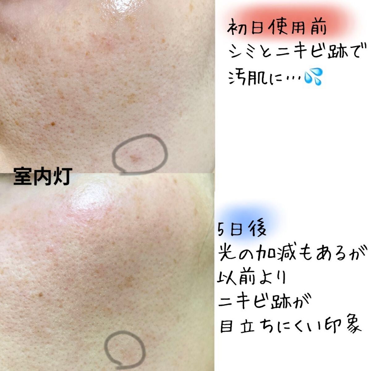 ハイドロクリームPHQ-8/KISO/美容液を使ったクチコミ(3枚目)