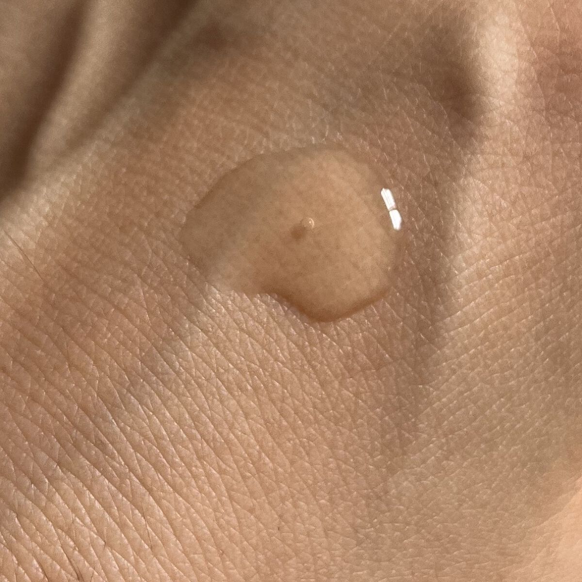 センテラ アンプル/SKIN1004/美容液を使ったクチコミ（3枚目）