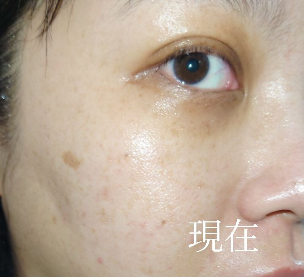 明色美顔水 薬用化粧水/美顔/化粧水を使ったクチコミ(2枚目)