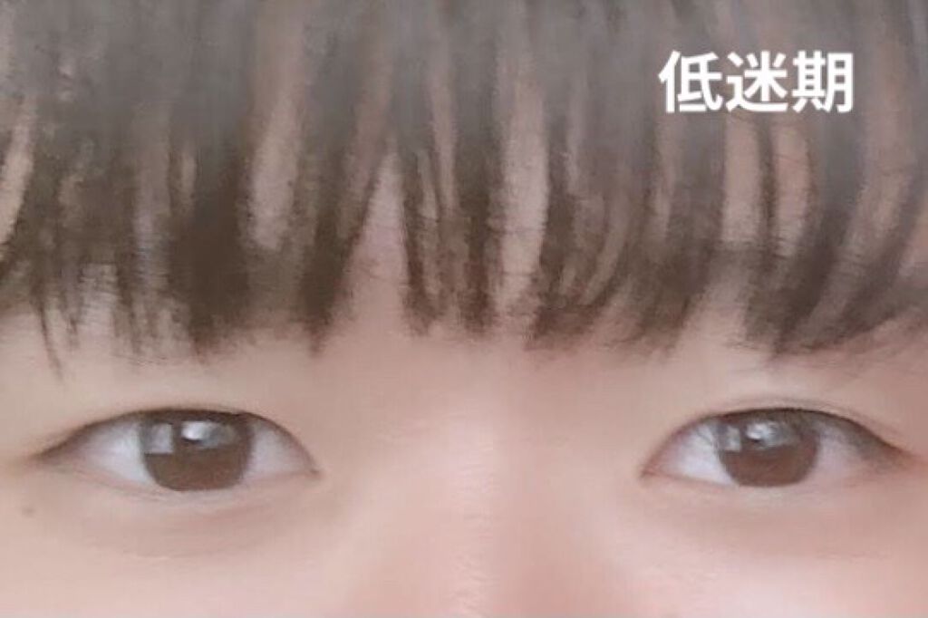 ルドゥーブル/ルドゥーブル/二重まぶた用アイテムを使ったクチコミ（3枚目）