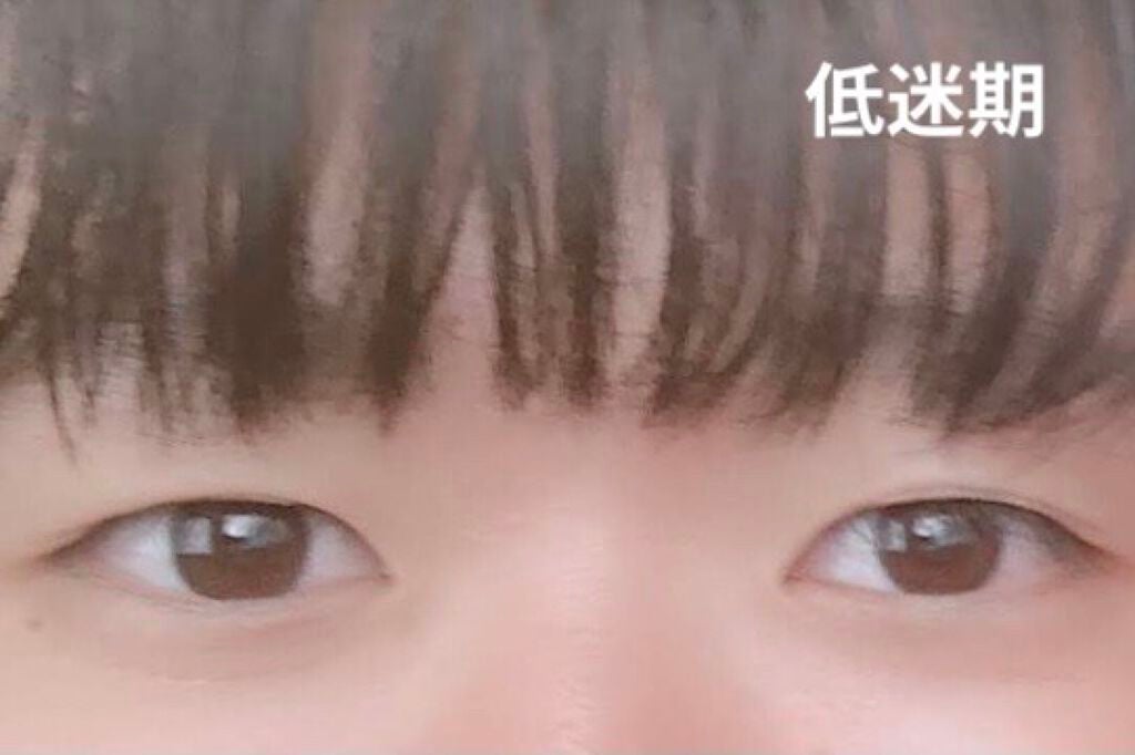 ルドゥーブル/ルドゥーブル/二重まぶた用アイテムを使ったクチコミ(3枚目)