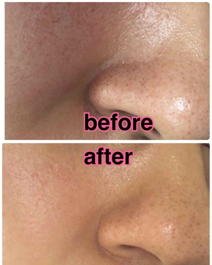 てごたえ お風呂場のスチームクリアケアセラム/ビオレ/洗い流すパック・マスクを使ったクチコミ(4枚目)