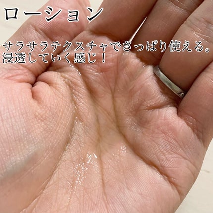VCスターターセット/VCシリーズ/スキンケアキットを使ったクチコミ(2枚目)