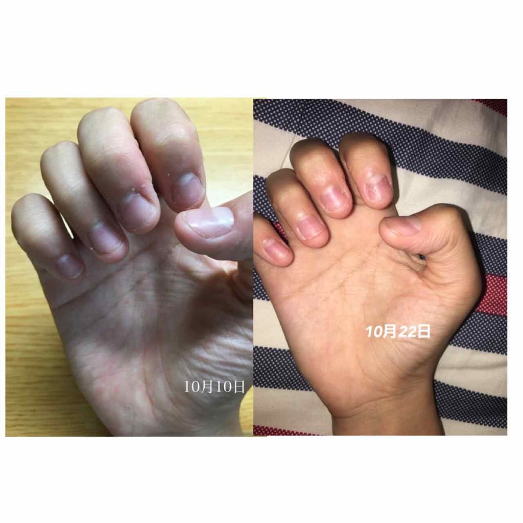 オリジナル ピュアスキンジェリー/ヴァセリン/ボディクリームを使ったクチコミ（2枚目）