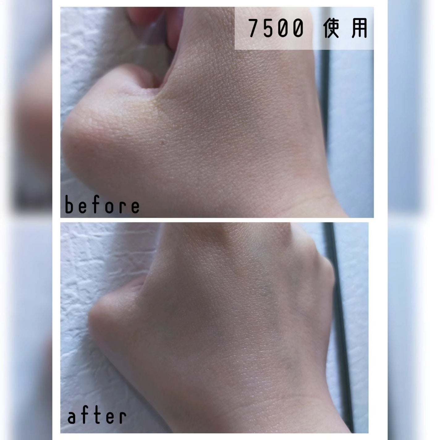 ゼロ1DAYエクソソームショット2000/MEDICUBE/美容液を使ったクチコミ(6枚目)