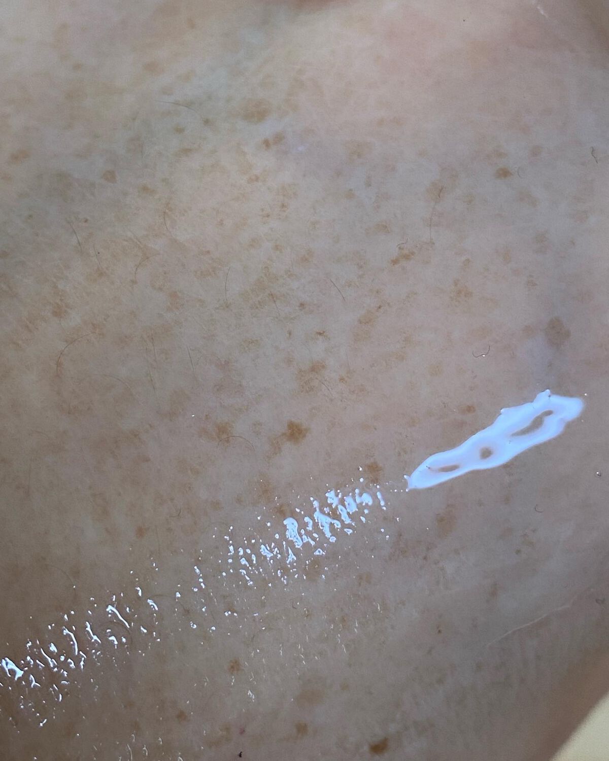 VC100ダブルリペアセラム/ドクターシーラボⓇ/美容液を使ったクチコミ(5枚目)