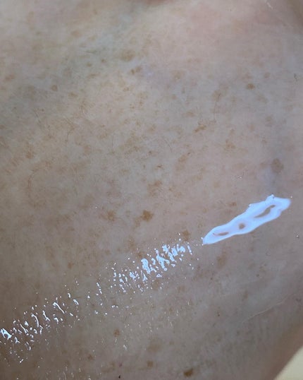 VC100ダブルリペアセラム/ドクターシーラボⓇ/美容液を使ったクチコミ(5枚目)