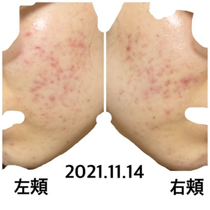 を使ったクチコミ(1枚目)