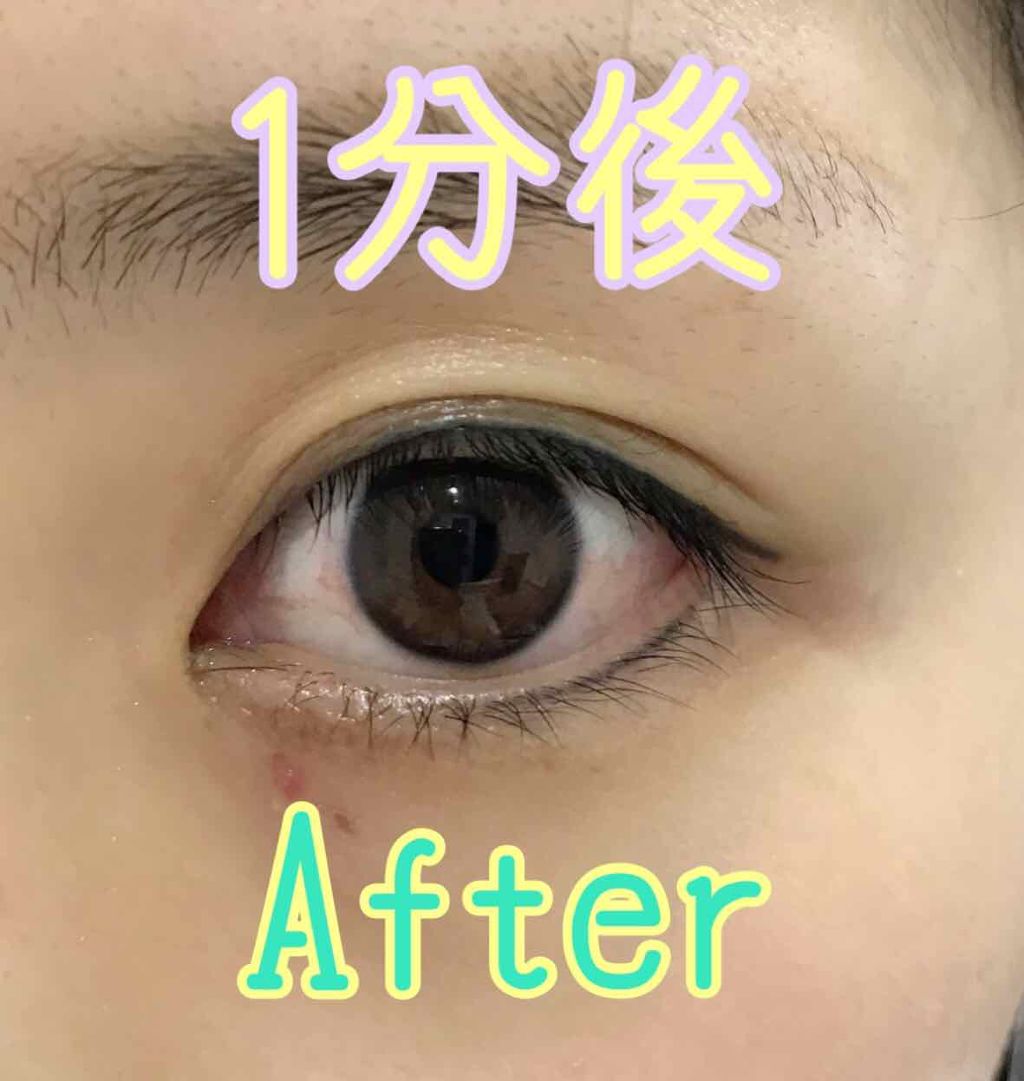 サンテ ボーティエ(医薬品)/参天製薬/その他を使ったクチコミ（3枚目）