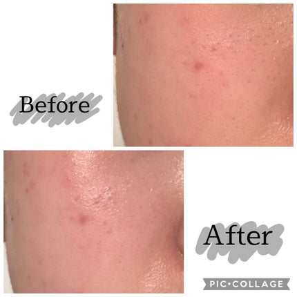 ジョンソン ベビーパウダー/ジョンソンベビー/ボディパウダーを使ったクチコミ(2枚目)