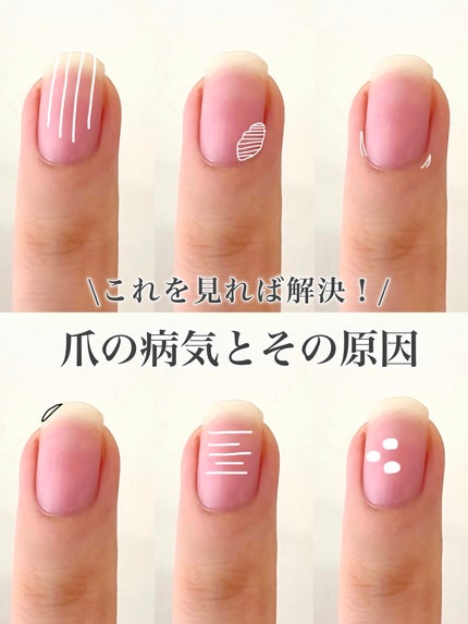 ビューティーチャージ ナイトスペリア/アトリックス/ハンドクリームを使ったクチコミ(1枚目)