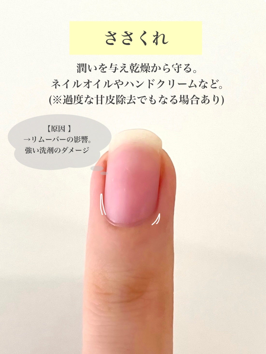 ビューティーチャージ ナイトスペリア/アトリックス/ハンドクリームを使ったクチコミ(6枚目)