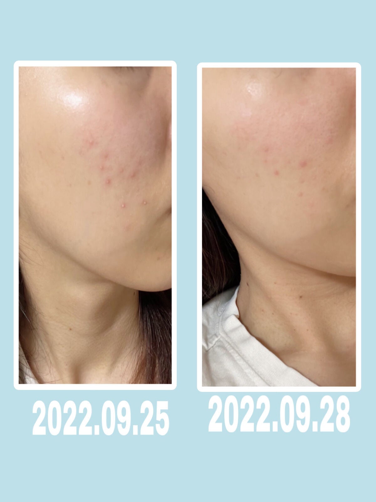 乳液・敏感肌用・しっとりタイプ/無印良品/乳液を使ったクチコミ(1枚目)