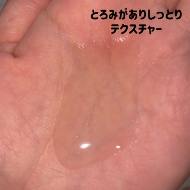 薬用マイクロバブルローション/Macchia Label/化粧水を使ったクチコミ（6枚目）
